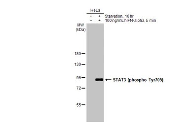 Anti-STAT3 (phospho Tyr705) antibody used in Western Blot (WB). GTX118000