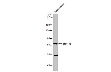 Anti-ZNF179 antibody used in Western Blot (WB). GTX118006