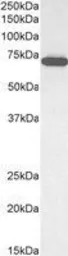 Anti-ELF1 antibody, C-term used in Western Blot (WB). GTX11801