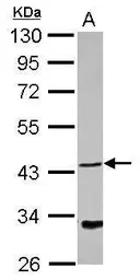 Anti-NDRG4 antibody used in Western Blot (WB). GTX118019