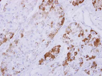 Anti-NDRG4 antibody used in IHC (Paraffin sections) (IHC-P). GTX118019