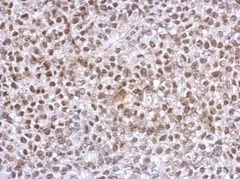 Anti-Homeobox C10 antibody used in IHC (Paraffin sections) (IHC-P). GTX118025