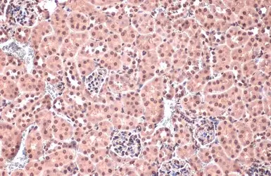 Anti-Homeobox C10 antibody used in IHC (Paraffin sections) (IHC-P). GTX118025