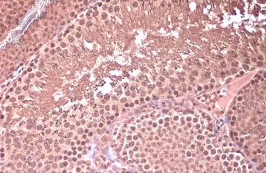 Anti-Homeobox C10 antibody used in IHC (Paraffin sections) (IHC-P). GTX118025