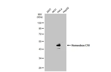 Anti-Homeobox C10 antibody used in Western Blot (WB). GTX118025