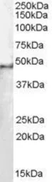 Anti-SF3B4 antibody, N-term used in Western Blot (WB). GTX11803
