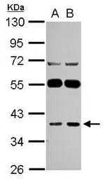 Anti-LANCL1 antibody used in Western Blot (WB). GTX118030