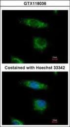 Anti-OSBPL5 antibody [N3C1], Internal used in Immunocytochemistry/ Immunofluorescence (ICC/IF). GTX118036