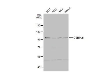 Anti-OSBPL5 antibody [N3C1], Internal used in Western Blot (WB). GTX118036