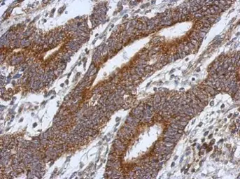 Anti-HS3ST2 antibody used in IHC (Paraffin sections) (IHC-P). GTX118041