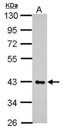 Anti-HS3ST2 antibody used in Western Blot (WB). GTX118041