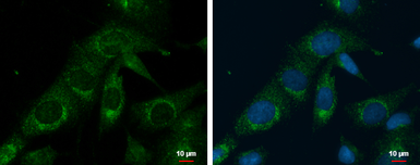 Anti-PRELID1 antibody [N1C3-2] used in Immunocytochemistry/ Immunofluorescence (ICC/IF). GTX118046