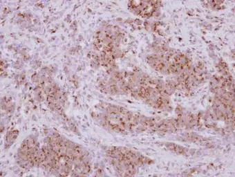Anti-PRELID1 antibody [N1C3-2] used in IHC (Paraffin sections) (IHC-P). GTX118046