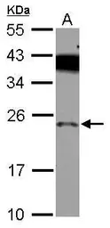 Anti-PRELID1 antibody [N1C3-2] used in Western Blot (WB). GTX118046
