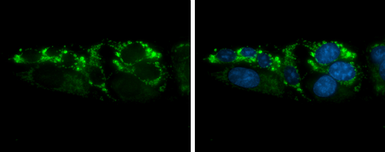 Anti-ARG2 antibody used in Immunocytochemistry/ Immunofluorescence (ICC/IF). GTX118048