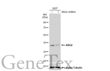 Anti-ARG2 antibody used in Western Blot (WB). GTX118048