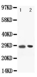 Anti-BOB1 antibody used in Western Blot (WB). GTX11807