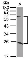 Anti-GALNT9 antibody [C1C3] used in Western Blot (WB). GTX118076