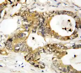 Anti-Annexin III antibody used in IHC (Paraffin sections) (IHC-P). GTX11808