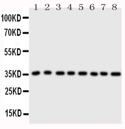 Anti-Annexin III antibody used in Western Blot (WB). GTX11808