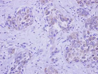 Anti-GALNT2 antibody [N3C3] used in IHC (Paraffin sections) (IHC-P). GTX118085