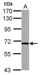 Anti-ICAM2 antibody [N1C3] used in Western Blot (WB). GTX118110