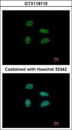 Anti-GAS41 antibody used in Immunocytochemistry/ Immunofluorescence (ICC/IF). GTX118115