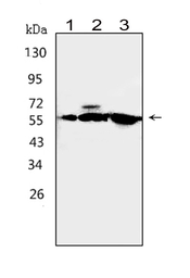Anti-CaMKK1 antibody used in Western Blot (WB). GTX11812