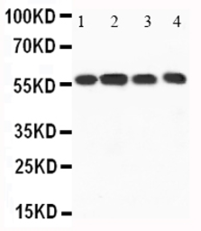 Anti-CaMKK1 antibody used in Western Blot (WB). GTX11812