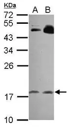Anti-RGS8 antibody [N1C3] used in Western Blot (WB). GTX118121