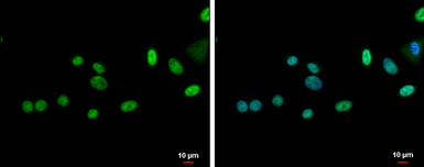 Anti-ZNF181 antibody used in Immunocytochemistry/ Immunofluorescence (ICC/IF). GTX118129