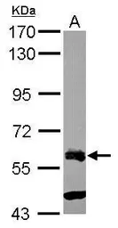 Anti-ZNF181 antibody used in Western Blot (WB). GTX118129