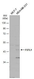 Anti-FSTL1 antibody [N1C2] used in Western Blot (WB). GTX118133