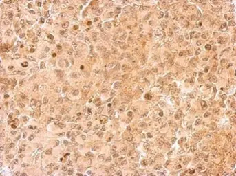 Anti-UFD1L antibody used in IHC (Paraffin sections) (IHC-P). GTX118138