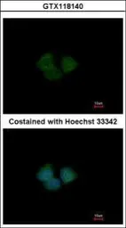 Anti-KLHL25 antibody [C1C3] used in Immunocytochemistry/ Immunofluorescence (ICC/IF). GTX118140