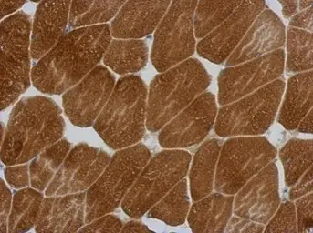 Anti-KLHL25 antibody [C1C3] used in IHC (Paraffin sections) (IHC-P). GTX118140