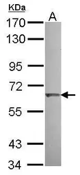 Anti-KLHL25 antibody [C1C3] used in Western Blot (WB). GTX118140