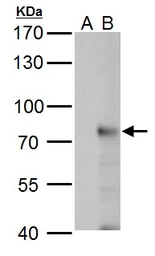 Anti-RNF168 antibody used in Western Blot (WB). GTX118147
