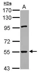 Anti-RNF168 antibody used in Western Blot (WB). GTX118147