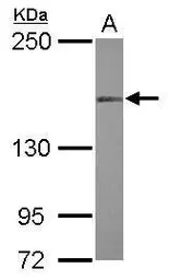 Anti-MLH3 antibody [N1N2], N-term used in Western Blot (WB). GTX118151