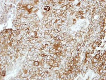 Anti-PCDHB16 antibody [N1N3] used in IHC (Paraffin sections) (IHC-P). GTX118159