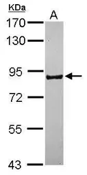 Anti-PCDHB16 antibody [N1N3] used in Western Blot (WB). GTX118159