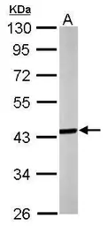 Anti-Septin 3 antibody [N2C3] used in Western Blot (WB). GTX118160