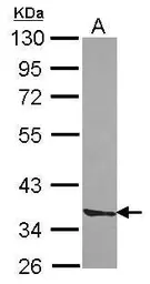 Anti-Septin 3 antibody [N2C3] used in Western Blot (WB). GTX118160