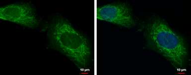 Anti-LONRF2 antibody used in Immunocytochemistry/ Immunofluorescence (ICC/IF). GTX118170