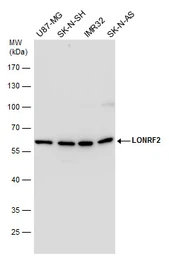 Anti-LONRF2 antibody used in Western Blot (WB). GTX118170