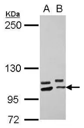 Anti-PCDHA10 antibody [N1N2], N-term used in Western Blot (WB). GTX118171