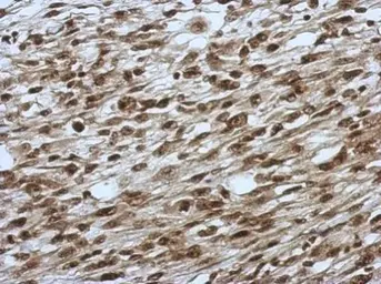 Anti-SLU7 antibody used in IHC (Paraffin sections) (IHC-P). GTX118180