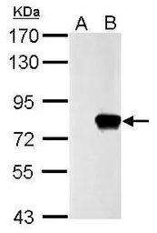 Anti-SLU7 antibody used in Western Blot (WB). GTX118180