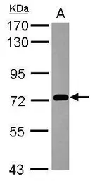 Anti-PCDHB3 antibody [N1C1] used in Western Blot (WB). GTX118185